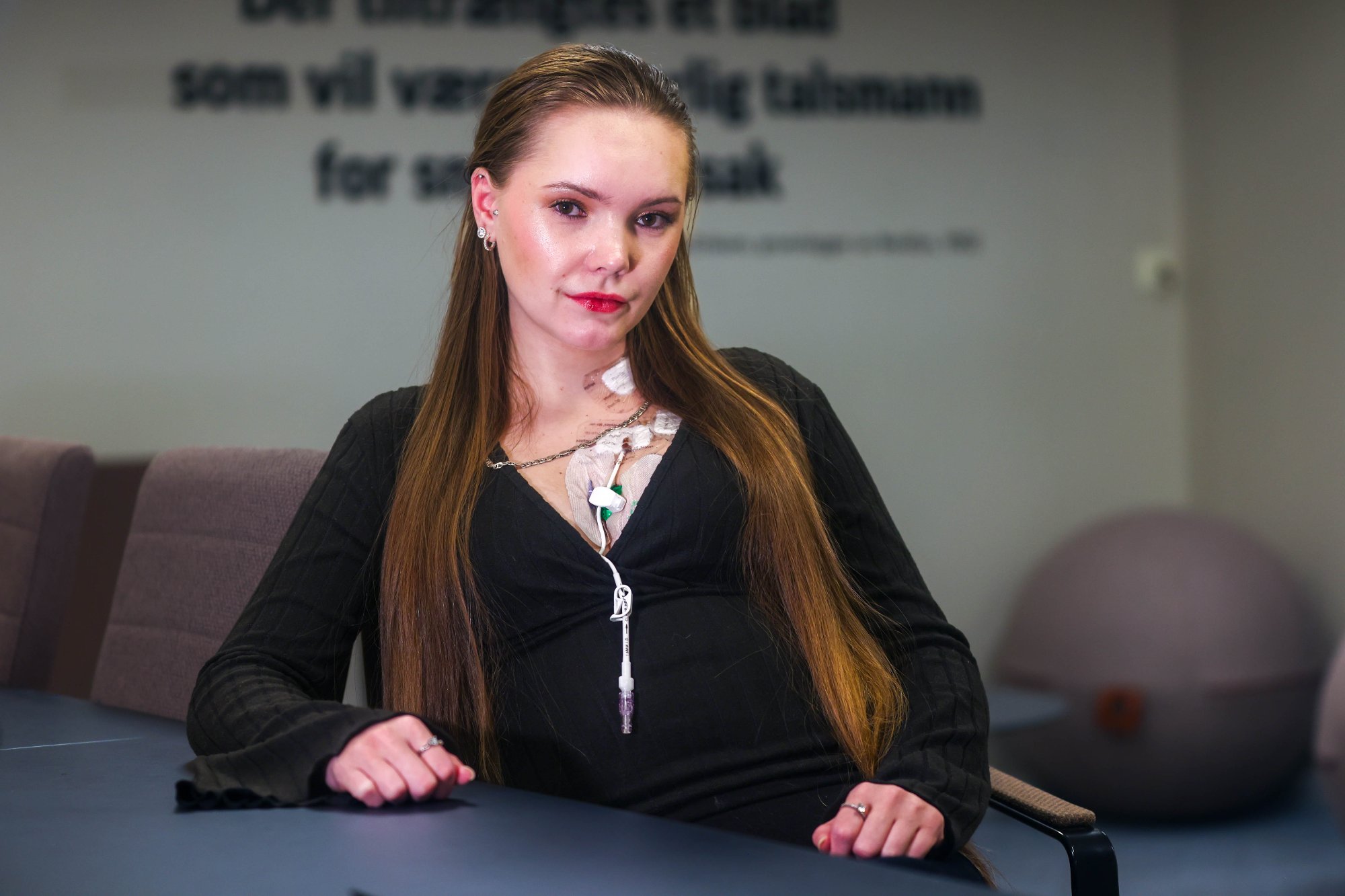 Natalie Haugstad (27) må legge opp hverdagen sin rundt sykdommen.
Hun bærer på Hennekam-syndrom – en av verdens mest sjeldne sykdommer. Hull i lymfebanene gjør at væske lekker ut i buken. 
Foto: Yngve Olsen