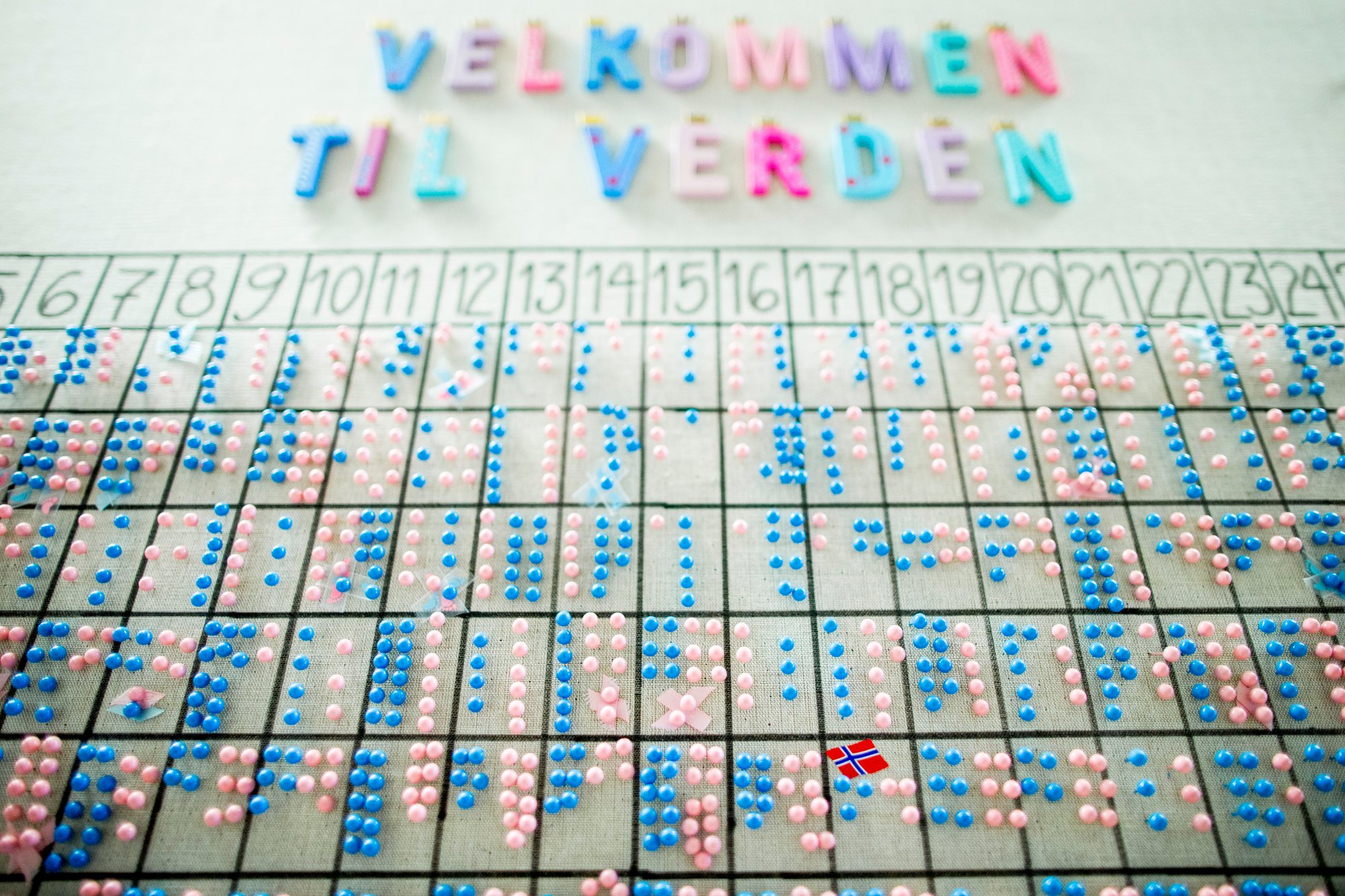 Keisersnitt-boom: – Systemet fungerer ikke