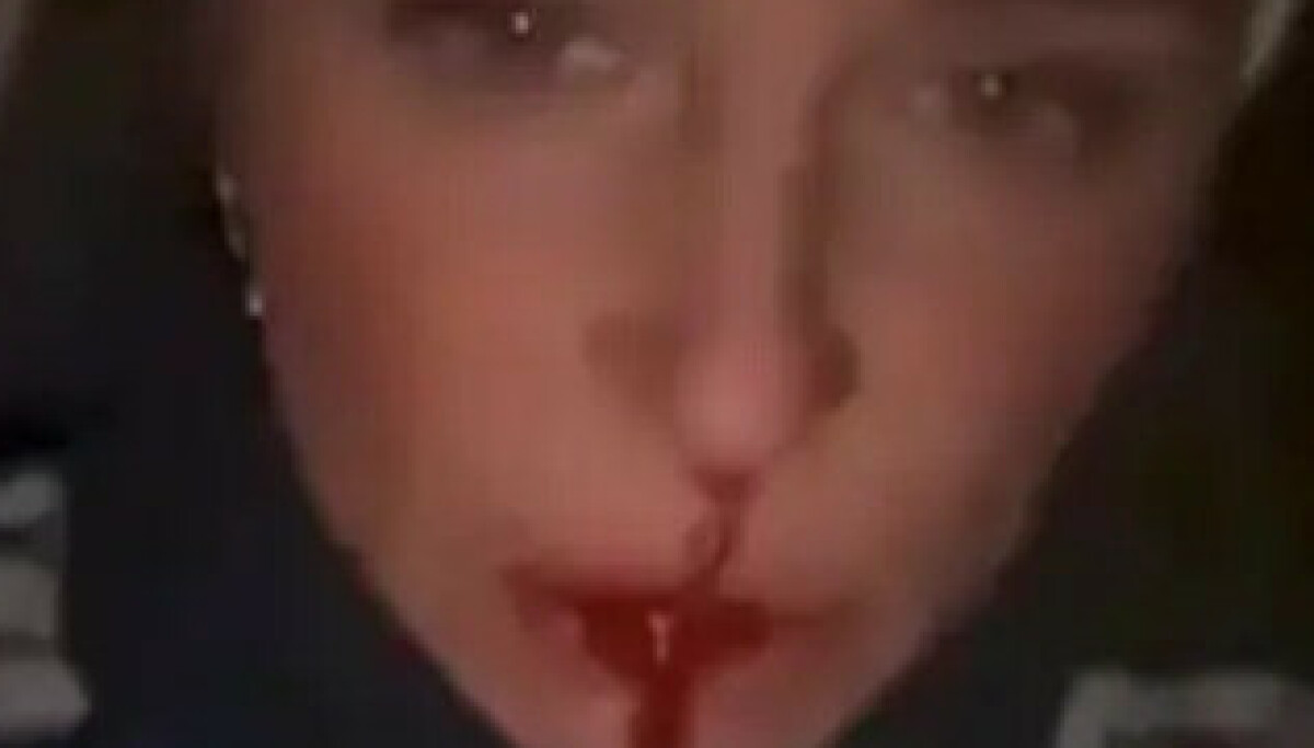 Deler blodige bilder