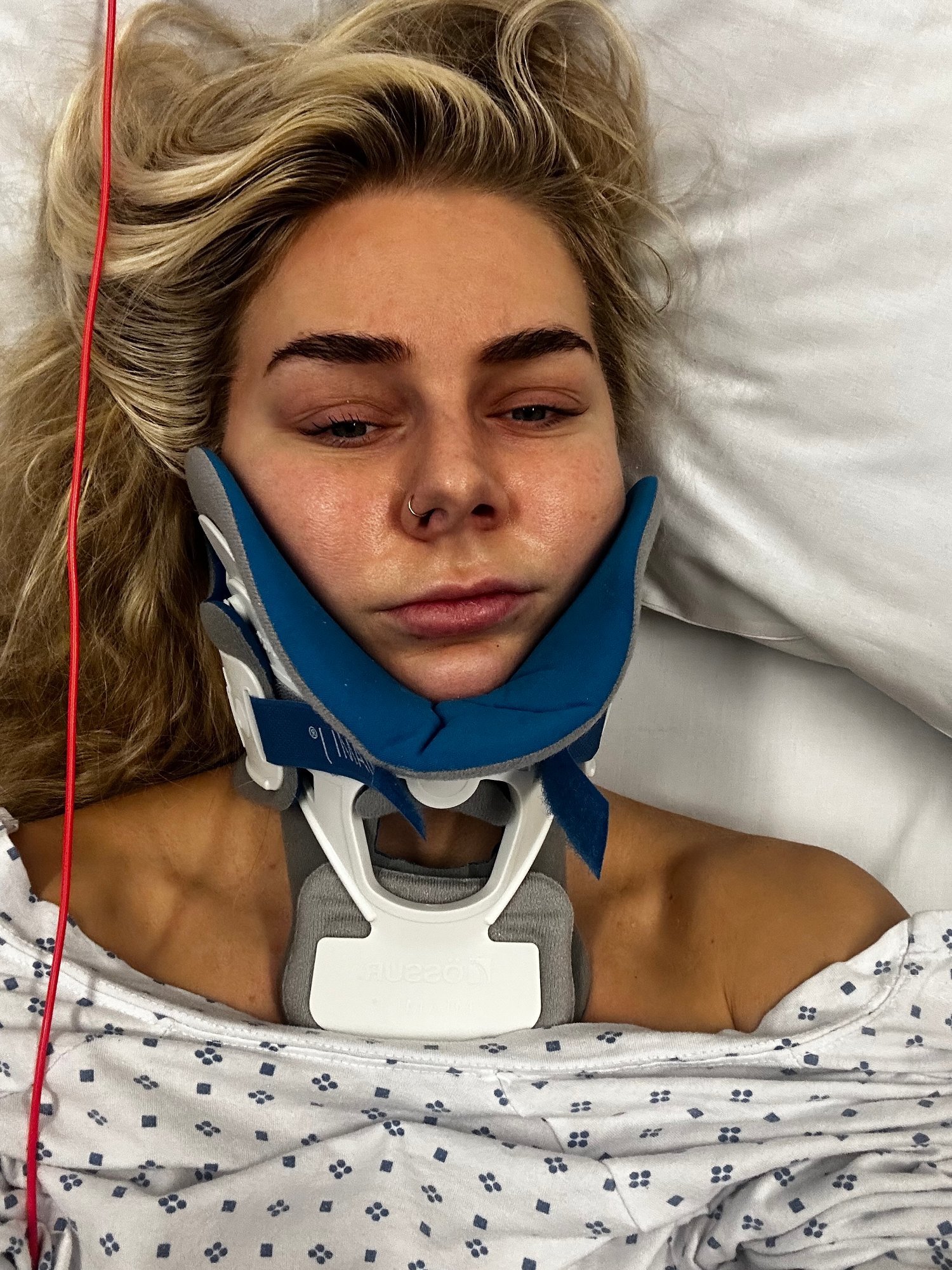 Marie (27) brakk nakken under treningsøkt: – Jeg er kjemperedd