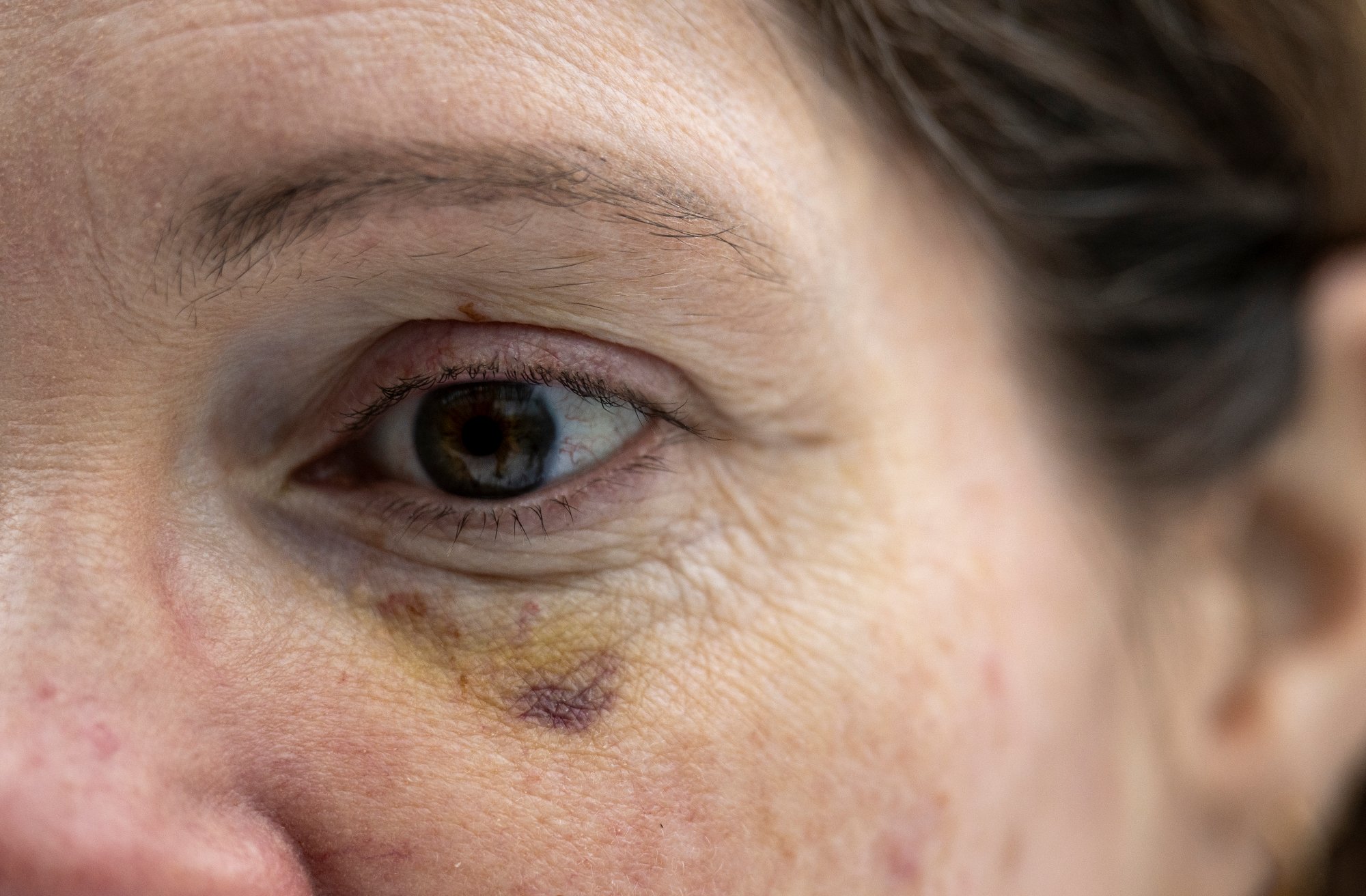 Gravide Kristin ble angrepet: – I et øyeblikk trodde jeg at jeg skulle dø